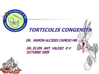 TORTICOLIS CONGENITA
 