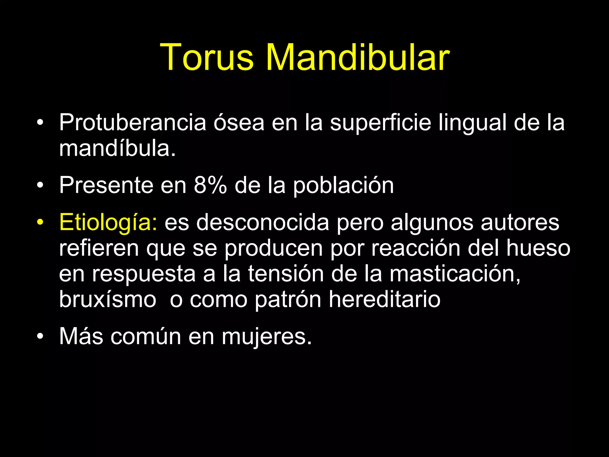 Torus Mandibular | PDF