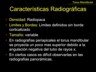 Torus Mandibular

  Características Radiográficas
• Densidad: Radiopaca
• Limites y Bordes: Limites definidos sin borde
  corticalizado
• Tamaño: variable
• En radiografías periapicales el torus mandibular
  se proyecta un poco mas superior debido a la
  angulación negativa del tubo de rayos x.
• En ciertos casos es difícil observarlas en las
  radiografías panorámicas.
 