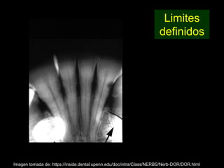 Limites
                                                                     definidos




Imagen tomada de: https://inside.dental.upenn.edu/doc/intra/Class/NERBS/Nerb-DOR/DOR.html
 