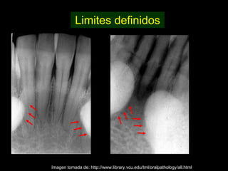 Limites definidos




Imagen tomada de: http://www.library.vcu.edu/tml/oralpathology/all.html
 