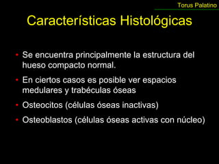 Torus Palatino

  Características Histológicas

• Se encuentra principalmente la estructura del
  hueso compacto normal.
• En ciertos casos es posible ver espacios
  medulares y trabéculas óseas
• Osteocitos (células óseas inactivas)
• Osteoblastos (células óseas activas con núcleo)
 