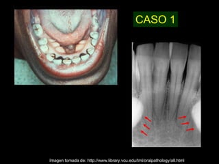 CASO 1




Imagen tomada de: http://www.library.vcu.edu/tml/oralpathology/all.html
 