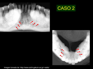 CASO 2




Imagen tomada de: http://www.aichi-gakuin.ac.jp/~radio/
 
