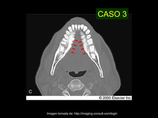 CASO 3




Imagen tomada de: http://imaging.consult.com/login
 