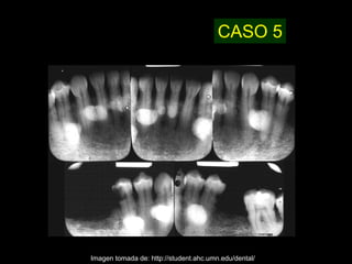 CASO 5




Imagen tomada de: http://student.ahc.umn.edu/dental/
 