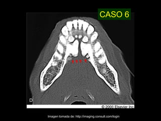 CASO 6




Imagen tomada de: http://imaging.consult.com/login
 