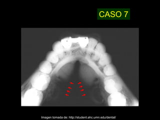 CASO 7




Imagen tomada de: http://student.ahc.umn.edu/dental/
 