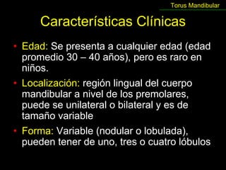 Torus Mandibular

      Características Clínicas
• Edad: Se presenta a cualquier edad (edad
  promedio 30 – 40 años), pero es raro en
  niños.
• Localización: región lingual del cuerpo
  mandibular a nivel de los premolares,
  puede se unilateral o bilateral y es de
  tamaño variable
• Forma: Variable (nodular o lobulada),
  pueden tener de uno, tres o cuatro lóbulos
 