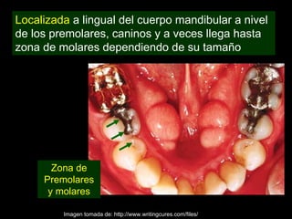 Localizada a lingual del cuerpo mandibular a nivel
de los premolares, caninos y a veces llega hasta
zona de molares dependiendo de su tamaño




       Zona de
     Premolares
      y molares

         Imagen tomada de: http://www.writingcures.com/files/
 