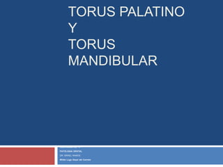TORUS PALATINO
Y
TORUS
MANDIBULAR
CUATRIMESTRE “4”
PATOLOGIA DENTAL
DR: ISRAEL RAMOS
Millán Lugo Geysi del Carmen
 