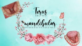Torus palatino y mandibular | PDF