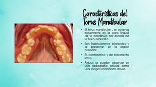 Torus palatino y mandibular | PDF