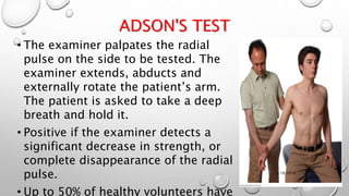 ADSON'S TEST
• The examiner palpates the radial
pulse on the side to be tested. The
examiner extends, abducts and
externally rotate the patient’s arm.
The patient is asked to take a deep
breath and hold it.
• Positive if the examiner detects a
significant decrease in strength, or
complete disappearance of the radial
pulse.
• Up to 50% of healthy volunteers have
3/18/2018
 