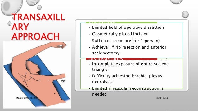 thoracic outlet syndrome test thoracic outlet syndrome test