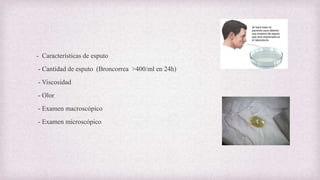 - Características de esputo
- Cantidad de esputo (Broncorrea >400/ml en 24h)
- Viscosidad
- Olor
- Examen macroscópico
- Examen microscópico
 