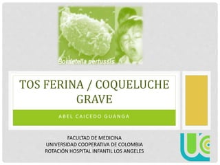 TOS FERINA / COQUELUCHE 
GRAVE 
A B E L C A I C E DO G UA N G A 
FACULTAD DE MEDICINA 
UNIVERSIDAD COOPERATIVA DE COLOMBIA 
ROTACIÓN HOSPITAL INFANTIL LOS ANGELES 
 