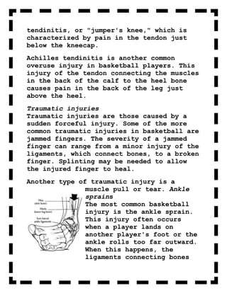 tendinitis, or "jumper's knee," which is
characterized by pain in the tendon just
below the kneecap.
Achilles tendinitis is another common
overuse injury in basketball players. This
injury of the tendon connecting the muscles
in the back of the calf to the heel bone
causes pain in the back of the leg just
above the heel.
Traumatic injuries
Traumatic injuries are those caused by a
sudden forceful injury. Some of the more
common traumatic injuries in basketball are
jammed fingers. The severity of a jammed
finger can range from a minor injury of the
ligaments, which connect bones, to a broken
finger. Splinting may be needed to allow
the injured finger to heal.
Another type of traumatic injury is a
               muscle pull or tear. Ankle
               sprains
               The most common basketball
               injury is the ankle sprain.
               This injury often occurs
               when a player lands on
               another player's foot or the
               ankle rolls too far outward.
               When this happens, the
               ligaments connecting bones
 