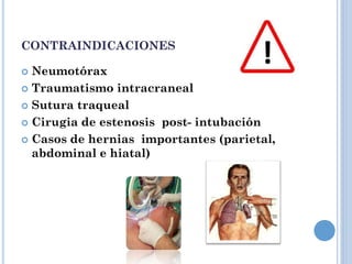 CONTRAINDICACIONES
 Neumotórax
 Traumatismo intracraneal
 Sutura traqueal
 Cirugia de estenosis post- intubación
 Casos de hernias importantes (parietal,
abdominal e hiatal)
 