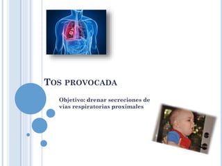 TOS PROVOCADA
Objetivo: drenar secreciones de
vías respiratorias proximales
 