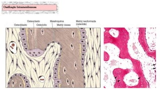 Ossificação Intramembranosa
 