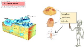 Matriz
Osteócito
Osteblasto
Osteclasto
Osteoprogenitora
Osteoclasto
Osteoblasto
Osteócito
CÉLULAS DO OSSO
 