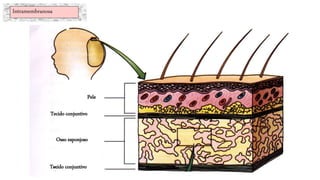 Pele
Tecido conjuntivo
Osso esponjoso
Tecido conjuntivo
Intramembranosa
 
