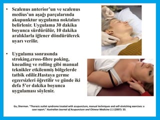 Gu, Sherman. "Thoracic outlet syndrome treated with acupuncture, manual techniques and self-stretching exercises: a
case report." Australian Journal of Acupuncture and Chinese Medicine 2.1 (2007): 33.
• Scalenus anterior’un ve scalenus
medius’un aşağı parçalarında
akupunktur uygulama noktaları
belirlenir. Uygulama 30 dakika
boyunca sürdürülür, 10 dakika
aralıklarla iğlener döndürülerek
uyarı verilir.
• Uygulama sonrasında
stroking,cross-fibre poking,
kneading ve rolling gibi manual
teknikler etkilenmiş bölgelerde
tatbik edilir.Hastaya germe
egzersizleri öğretilir ve günde iki
defa 5’er dakika boyunca
uygulaması söylenir.
 