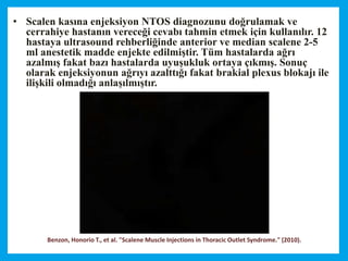 Benzon, Honorio T., et al. "Scalene Muscle Injections in Thoracic Outlet Syndrome." (2010).
• Scalen kasına enjeksiyon NTOS diagnozunu doğrulamak ve
cerrahiye hastanın vereceği cevabı tahmin etmek için kullanılır. 12
hastaya ultrasound rehberliğinde anterior ve median scalene 2-5
ml anestetik madde enjekte edilmiştir. Tüm hastalarda ağrı
azalmış fakat bazı hastalarda uyuşukluk ortaya çıkmış. Sonuç
olarak enjeksiyonun ağrıyı azalttığı fakat brakial plexus blokajı ile
ilişkili olmadığı anlaşılmıştır.
 