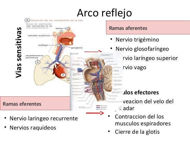 Tos y hemoptisis