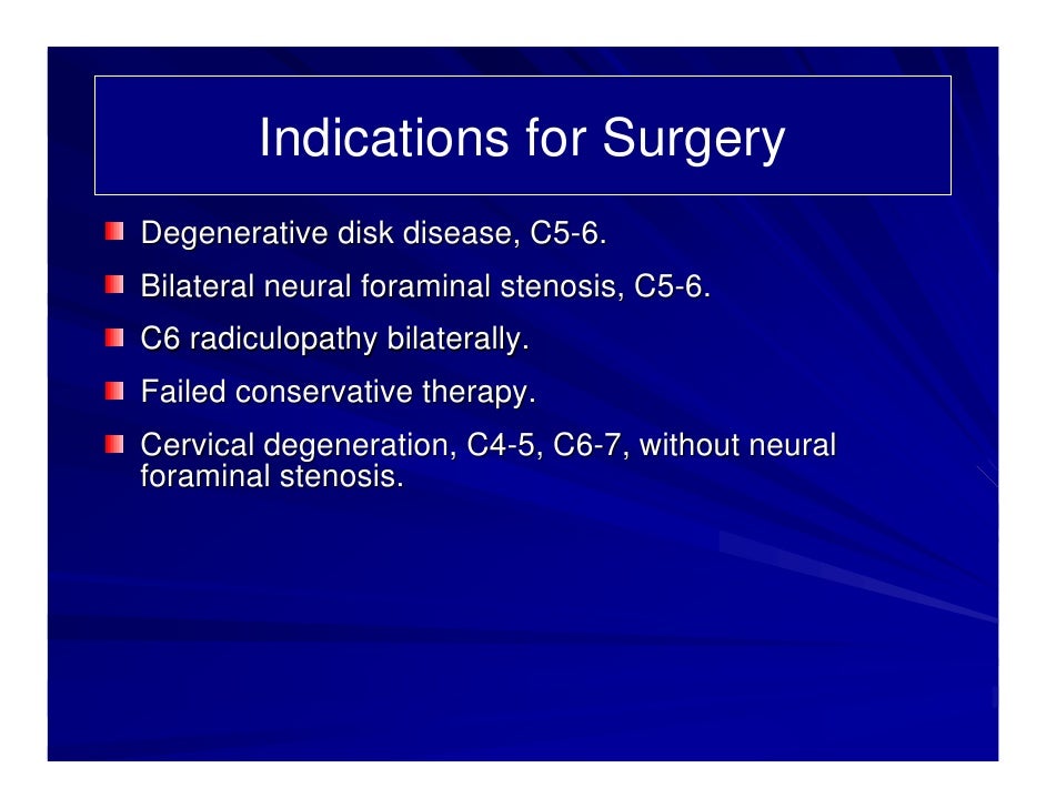 Case Review #7: 51 year old female with Prestige Cervical Disc Replac…