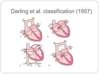 Darling Classification Total anomalous pulmonary venous connection | PPTX