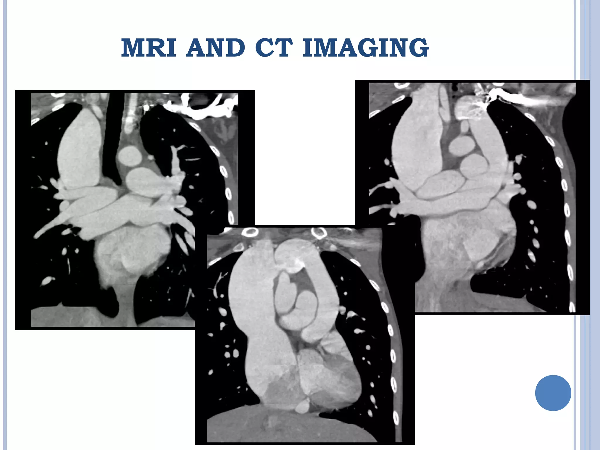 MRI AND CT IMAGING
 