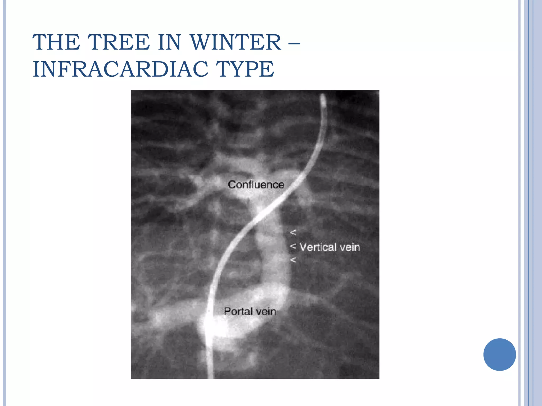 THE TREE IN WINTER –
INFRACARDIAC TYPE
 