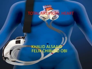 Total Artificial Heart
Khalid Alsaaid
Felix Chibuzo Obi
TOTAL ARTIFICIAL HEART
FELIX CHIBUZO OBI
KHALID ALSAAID
 
