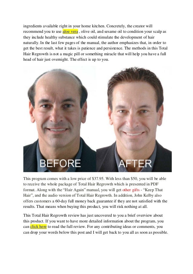 Total Hair Regrowth Review Exposes John Kelby S Hair Loss Cure