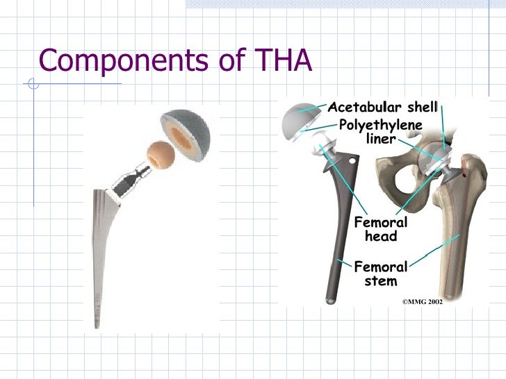 Total Hip Arthroplasty For Ccu