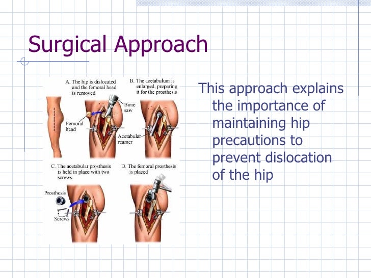Total Hip Arthroplasty For Ccu
