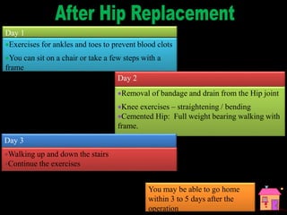 Day 1
Exercises for ankles and toes to prevent blood clots
You can sit on a chair or take a few steps with a
frame
Day 2
Removal of bandage and drain from the Hip joint
Knee exercises – straightening / bending
Cemented Hip: Full weight bearing walking with
frame.
Day 3
Walking up and down the stairs
Continue the exercises
You may be able to go home
within 3 to 5 days after the
operation
 
