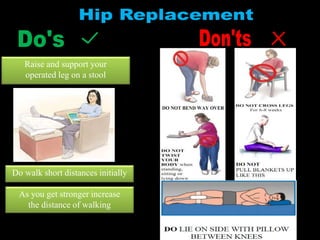 Raise and support your
operated leg on a stool
Do walk short distances initially
As you get stronger increase
the distance of walking
 