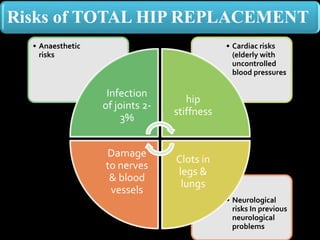 • Neurological
risks In previous
neurological
problems
• Cardiac risks
(elderly with
uncontrolled
blood pressures
• Anaesthetic
risks
Infection
of joints 2-
3%
hip
stiffness
Clots in
legs &
lungs
Damage
to nerves
& blood
vessels
Risks of TOTAL HIP REPLACEMENT
 