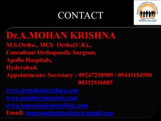CONTACT
Dr.A.MOHAN KRISHNA
M.S.Ortho., MCh Ortho(U.K).,
Consultant Orthopaedic Surgeon,
Apollo Hospitals,
Hyderabad.
Appointments: Secretary : 09247258989 / 09441184590
08332936085
www.drmohankrishna.com
www.healthyjointclub.com
www.bonesandjointsclinic.com
Email: bonesandjointsclinic@gmail.com
 