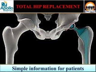 TOTAL HIP REPLACEMENT
 