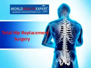 Total Hip Replacement
Surgery
 