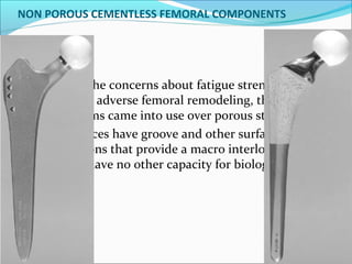 NON POROUS CEMENTLESS FEMORAL COMPONENTS
 With the concerns about fatigue strength, ion
release and adverse femoral remodeling, these non
porous stems came into use over porous stems.
These devices have groove and other surface
modifications that provide a macro interlock with
bone, but have no other capacity for biologic fixation.
 