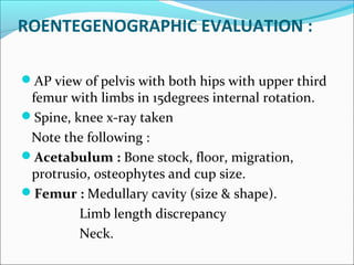 ROENTEGENOGRAPHIC EVALUATION :
AP view of pelvis with both hips with upper third
femur with limbs in 15degrees internal rotation.
Spine, knee x-ray taken
Note the following :
Acetabulum : Bone stock, floor, migration,
protrusio, osteophytes and cup size.
Femur : Medullary cavity (size & shape).
Limb length discrepancy
Neck.
 