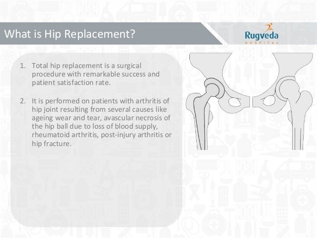 Total hip replacement – a patient guide