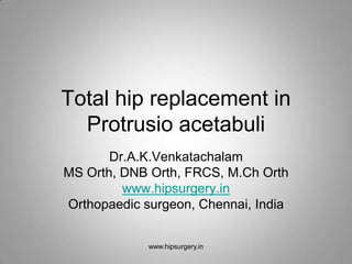 Total hip replacement in
  Protrusio acetabuli
       Dr.A.K.Venkatachalam
MS Orth, DNB Orth, FRCS, M.Ch Orth
         www.hipsurgery.in
Orthopaedic surgeon, Chennai, India


             www.hipsurgery.in
 