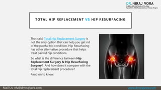 Total hip replacement vs hip resurfacing | PPTX