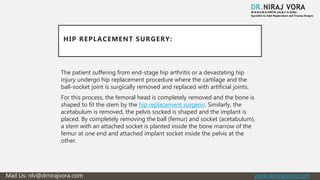 Total hip replacement vs hip resurfacing | PPTX